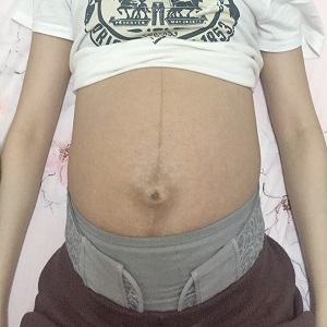 【這個則是沒有使用托腹帶的厭世肚肚】 【這個則是沒有使用托腹帶的厭世肚肚】